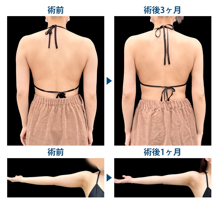 ピックアップ症例写真